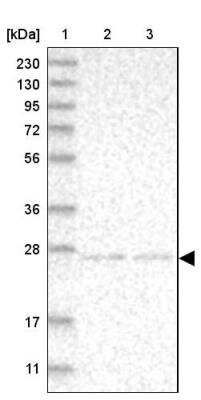 Western Blot: NT5C Antibody [NBP1-84564] - Lane 1: Marker  [kDa] 230, 130, 95, 72, 56, 36, 28, 17, 11.  Lane 2: Human cell line RT-4.  Lane 3: Human cell line U-251MG sp