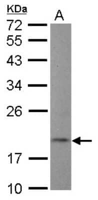 Western Blot: NT5C Antibody [NBP2-19596] - Sample (30 ug of whole cell lysate) A: Raji 12% SDS PAGE gel, diluted at 1:1000.