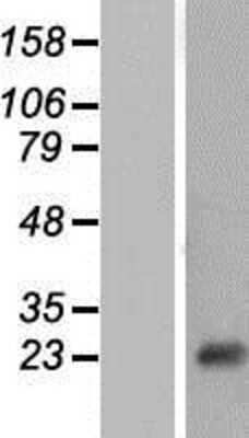 Western Blot: NT5C Overexpression Lysate (Adult Normal) [NBP2-07309] Left-Empty vector transfected control cell lysate (HEK293 cell lysate); Right -Over-expression Lysate for NT5C.