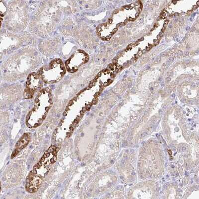 Immunohistochemistry: NT5C1A Antibody [NBP2-48604] - Staining of human kidney shows strong cytoplasmic positivity in a subset of tubules.