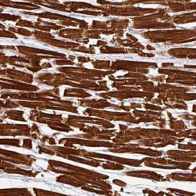 Immunohistochemistry-Paraffin: NT5C1A Antibody [NBP2-49121] - Staining of human heart muscle shows cytoplasmic positivity in myocytes.