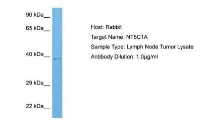 Western Blot: NT5C1A Antibody [NBP2-85408] - Host: Rabbit. Target Name: NT5C1A. Sample Tissue: Human Lymph Node Tumor lysates. Antibody Dilution: 1ug/ml