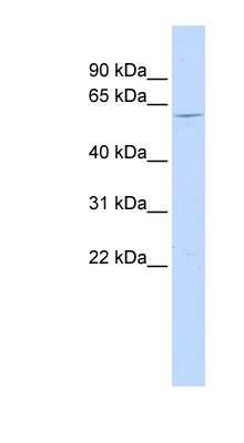 Western Blot: NT5C1B Antibody [NBP1-56911] - Titration: 0.2-1 ug/ml, Positive Control: Human Liver.