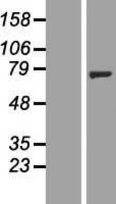 Western Blot: NT5C1B Overexpression Lysate (Adult Normal) [NBP2-05901] Left-Empty vector transfected control cell lysate (HEK293 cell lysate); Right -Over-expression Lysate for NT5C1B.