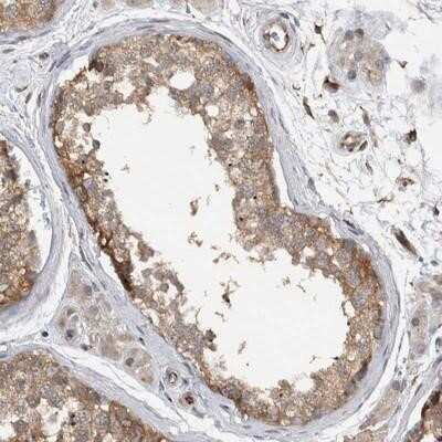 Immunohistochemistry-Paraffin: NT5C2 Antibody [NBP1-85526] - Staining of human testis shows cytoplasmic positivity in seminiferus duct cells.