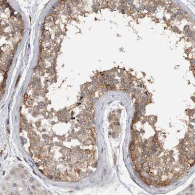 Immunohistochemistry-Paraffin: NT5C2 Antibody [NBP1-85526] - Staining of human testis shows weak to moderate cytoplasmic positivity in cells in tubules.