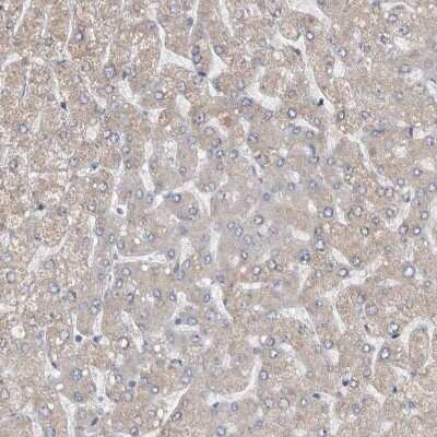 Immunohistochemistry-Paraffin: NT5C2 Antibody [NBP1-85526] - Staining of human liver shows weak to moderate cytoplasmic positivity in hepatocytes.