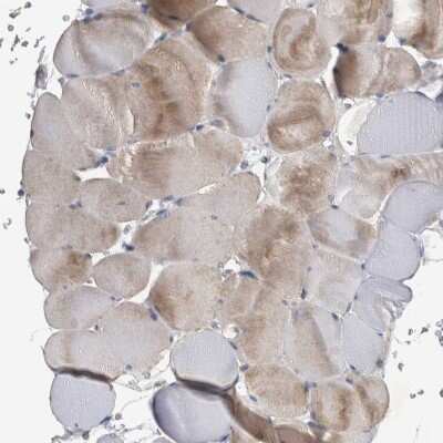 Immunohistochemistry-Paraffin: NT5C2 Antibody [NBP1-85526] - Staining of human skeletal muscle shows weak to moderate cytoplasmic positivity in myocytes.