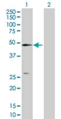 Western Blot: NT5C2 Antibody [H00022978-D01P] - Analysis of NT5C2 expression in transfected 293T cell line by NT5C2 polyclonal antibody.Lane 1: NT5C2 transfected lysate(65.00 KDa).Lane 2: Non-transfected lysate.