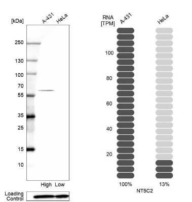 Western Blot: NT5C2 Antibody [NBP1-85526] - Analysis in human cell line A-431 and human cell line HeLa.