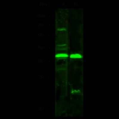 Western Blot: NT5C3 Antibody [NBP3-00212] - Anti-NT5C3 rabbit polyclonal antibody at 1:500 dilution. Lane A: Jurkat Whole Cell Lysate. Lane B: HepG2 Whole Cell Lysate. Lysates/proteins at 30 ug per lane. Secondary Goat Anti-Rabbit IgG H&L (Dylight 800) at 1/10000 dilution. Developed using the Odyssey technique. Performed under reducing conditions. Predicted band size: 38 kDa. Observed band size: 37 kDa (We are unsure as to the identity of these extra bands).