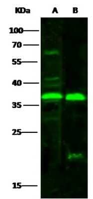 Western Blot: NT5C3 Antibody [NBP3-00212] - Anti-NT5C3 rabbit polyclonal antibody at 1:500 dilution. Lane A: Jurkat Whole Cell Lysate. Lane B: HepG2 Whole Cell Lysate. Lysates/proteins at 30 ug per lane. Secondary Goat Anti-Rabbit IgG H&L (Dylight 800) at 1/10000 dilution. Developed using the Odyssey technique. Performed under reducing conditions. Predicted band size: 38 kDa. Observed band size: 37 kDa (We are unsure as to the identity of these extra bands).