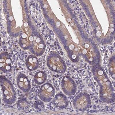 Immunohistochemistry-Paraffin NT5M Antibody