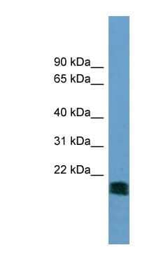 Western Blot: NT5M Antibody [NBP1-54683] - A549 cell lysate, concentration 0.2-1 ug/ml.