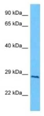 Western Blot: NT5M Antibody [NBP3-10056] - Western blot analysis of NT5M in Human U937 Whole Cell lysates. Antibody dilution at 1ug/ml