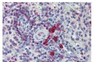 Immunohistochemistry: NTAL Antibody [NBP1-44948] - Staining of human spleen (paraffin sections) with anti-NTAL polyclonal. 