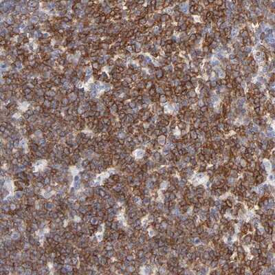 Immunohistochemistry-Paraffin: NTAL Antibody [NBP1-89661] - Staining of human tonsil shows strong cytoplasmic positivity in reaction center cells.