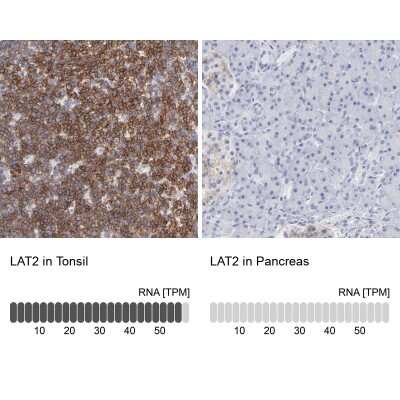 <b>Orthogonal Strategies Validation. </b>Immunohistochemistry-Paraffin: NTAL Antibody [NBP1-89661] - Staining in human tonsil and pancreas tissues using anti-LAT2 antibody. Corresponding LAT2 RNA-seq data are presented for the same tissues.