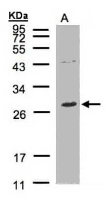 Western Blot: NTAL Antibody [NBP1-31177] - Sample(30 ug of whole cell lysate)A:Raji 12% SDS PAGE, antibody diluted at 1:500.