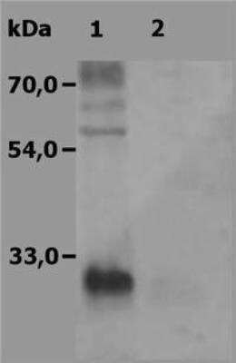 Western Blot: NTAL Antibody [NBP1-44948] - Analysis (non-reducing conditions) of NTAL-transfected HEK-293 FT cells using polyclonal anti-human NTAL antibody.  Lane 1: cell lysate of transfected HEK-293 FT cells  Lane 2: cell lysate of non-transfected HEK-293 FT cells (negative control)  (HEK-293 FT is a subclone of the primary human embryonal kidney epithelial cell line.)