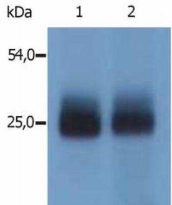Western Blot: NTAL Antibody [NBP1-45076] - Analysis (non-reducing conditions) of mouse NTAL in mouse spleen tissue.  Lane 1: immunostaining with polyclonal anti-NTAL antibody  Lane 2: immunostaining with polyclonal anti-mouse NTAL antibody (specific for N-terminal domain of mouse NTAL)