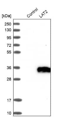 Western Blot: NTAL Antibody [NBP1-89661] - Analysis in control (vector only transfected HEK293T lysate) and LAT2 over-expression lysate (Co-expressed with a C-terminal myc-DDK tag (3.1 kDa) in mammalian HEK293T cells).