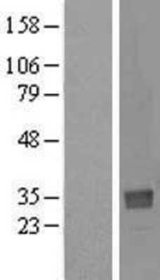 Western Blot: NTAN1 Overexpression Lysate (Adult Normal) [NBL1-13829] Left-Empty vector transfected control cell lysate (HEK293 cell lysate); Right -Over-expression Lysate for NTAN1.