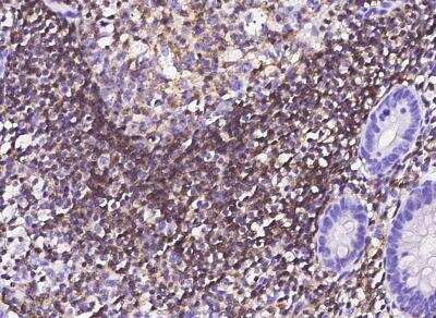 Immunohistochemistry-Paraffin: NTB-A/SLAMF6/CD352 Antibody (005) [NBP2-90027] - Staining of human SLAMF6 in human appendix with rabbit monoclonal antibody (1:200).