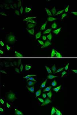 Immunocytochemistry/ Immunofluorescence NTF2 Antibody - BSA Free