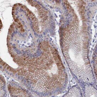 Immunohistochemistry: NTF2 Antibody [NBP1-82521] - Staining of human stomach shows moderate cytoplasmic positivity in glandular cells.