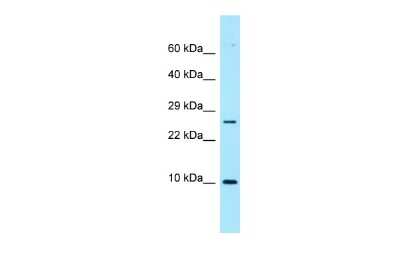 Western Blot: NTF2 Antibody [NBP2-87952] - WB Suggested Anti-NUTF2 Antibody. Titration: 1.0 ug/ml. Positive Control: ACHN Whole CellNUTF2 is supported by BioGPS gene expression data to be expressed in ACHN