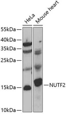 Western Blot: NTF2 Antibody [NBP2-94526] - Analysis of extracts of various cell lines, using NTF2 at 1:1000 dilution.Secondary antibody: HRP Goat Anti-Rabbit IgG (H+L) at 1:10000 dilution.Lysates/proteins: 25ug per lane.Blocking buffer: 3% nonfat dry milk in TBST.Detection: ECL Basic Kit .Exposure time: 90s.