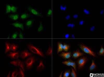 Immunocytochemistry/Immunofluorescence: NTH1 Antibody [NB100-302] - The NTH1 antibody was tested in Hela cells at a 1:500 dilution against Dylight 488 (Green).  Alpha-tubulin and nuclei were counterstained against Dylight 550 (Red) and DAPI (Blue).  