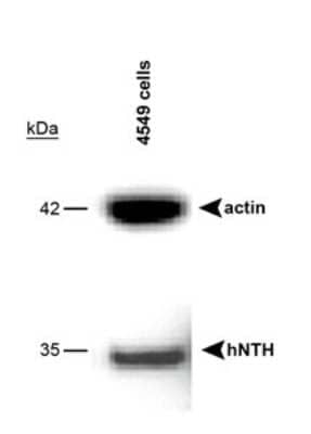 Western Blot: NTH1 Antibody [NB100-302] - Analysis of A549 cells using NB100-302. A band is seen at 35 kDa representing NTH1.