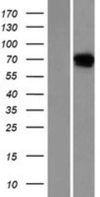 Western Blot: Netrin-4 Overexpression Lysate (Native) [NBP2-06541] - Left-Empty vector transfected control cell lysate (HEK293 cell lysate); Right -Over-expression Lysate for NTN4.