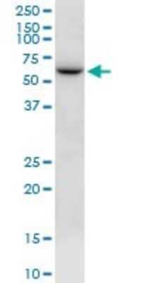 Western Blot: NTN5 Antibody [H00126147-B01P] - Analysis of NTN5 expression in Jurkat.