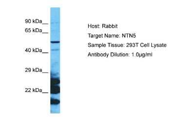 Western Blot: NTN5 Antibody [NBP2-84193] - Host: Rabbit. Target Name: NTN5. Sample Type: 293T Whole Cell lysates. Antibody Dilution: 1.0ug/ml