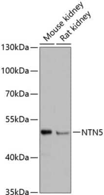 Western Blot: NTN5 Antibody [NBP2-93713] - Analysis of extracts of various cell lines, using NTN5 at 1:3000 dilution.Secondary antibody: HRP Goat Anti-Rabbit IgG (H+L) at 1:10000 dilution.Lysates/proteins: 25ug per lane.Blocking buffer: 3% nonfat dry milk in TBST.Detection: ECL Basic Kit .Exposure time: 90s.