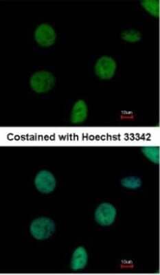 Immunocytochemistry/Immunofluorescence: NTPCR Antibody [NBP1-31146] - Paraformaldehyde-fixed HeLa, using antibody at 1:500 dilution.