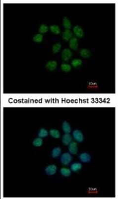 Immunocytochemistry/Immunofluorescence: NTPCR Antibody [NBP2-19598] - Analysis of methanol-fixed A431, using antibody at 1:200 dilution.