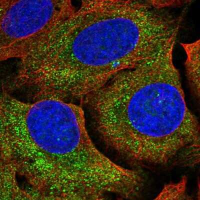 Immunocytochemistry/Immunofluorescence: NTPCR Antibody [NBP2-38724] - Immunofluorescent staining of human cell line U-2 OS shows localization to cytosol.