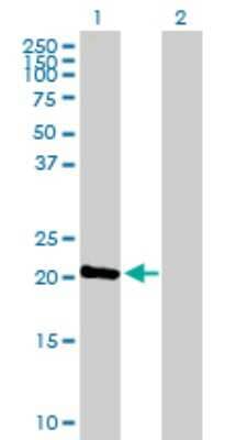 Western Blot: NTPCR Antibody [H00084284-B01P] - Analysis of C1orf57 expression in transfected 293T cell line by C1orf57 polyclonal antibody.  Lane 1: C1orf57 transfected lysate(20.9 KDa). Lane 2: Non-transfected lysate.