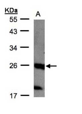 Western Blot: NTPCR Antibody [NBP1-31146] - (30 ug of whole cell lysate) A: MOLT4 12% SDS PAGE, antibody diluted at 1:1000.