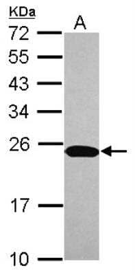 Western Blot: NTPCR Antibody [NBP2-19598] - Sample (30 ug of whole cell lysate) A: Jurkat 12% SDS PAGE gel, diluted at 1:1000.