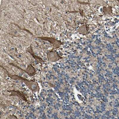 Immunohistochemistry-Paraffin NUAK2 Antibody