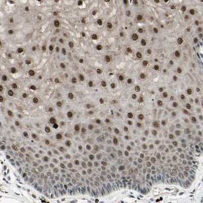 Immunohistochemistry-Paraffin NUAK2 Antibody