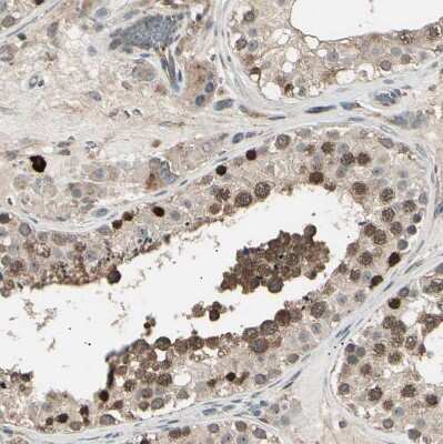 Immunohistochemistry-Paraffin: NUAK2 Antibody [NBP1-81880] - Staining of human testis shows moderate to strong cytoplasmic and nuclear positivity in cells in seminiferous ducts.