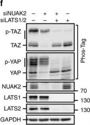 Knockdown Validated: NUAK2 Antibody [NBP1-81880] - NUAK2 regulates YAP/TAZ activity through LATS. NUAK2 requires LATS to regulate YAP/TAZ localization, phosphorylation, and target gene expression in MDA-MB231 cells. YAP/TAZ phosphorylation was monitored using Phos-Tag gels. Relative phosphorylation levels from blots is quantitated (right). Image collected and cropped by CiteAb from the following publication (//www.nature.com/articles/s41467-018-05939-2), licensed under a CC-BY license.