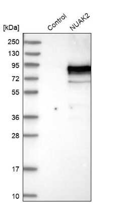 Western Blot NUAK2 Antibody