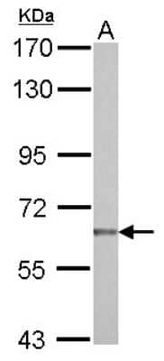 Western Blot: NUAK2 Antibody [NBP2-19599] - Sample (30 ug of whole cell lysate) A: NT2D1 7. 5% SDS PAGE gel, diluted at 1:1000.